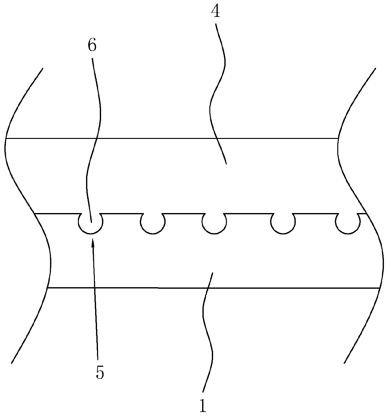 Removable denture and manufacturing technology thereof