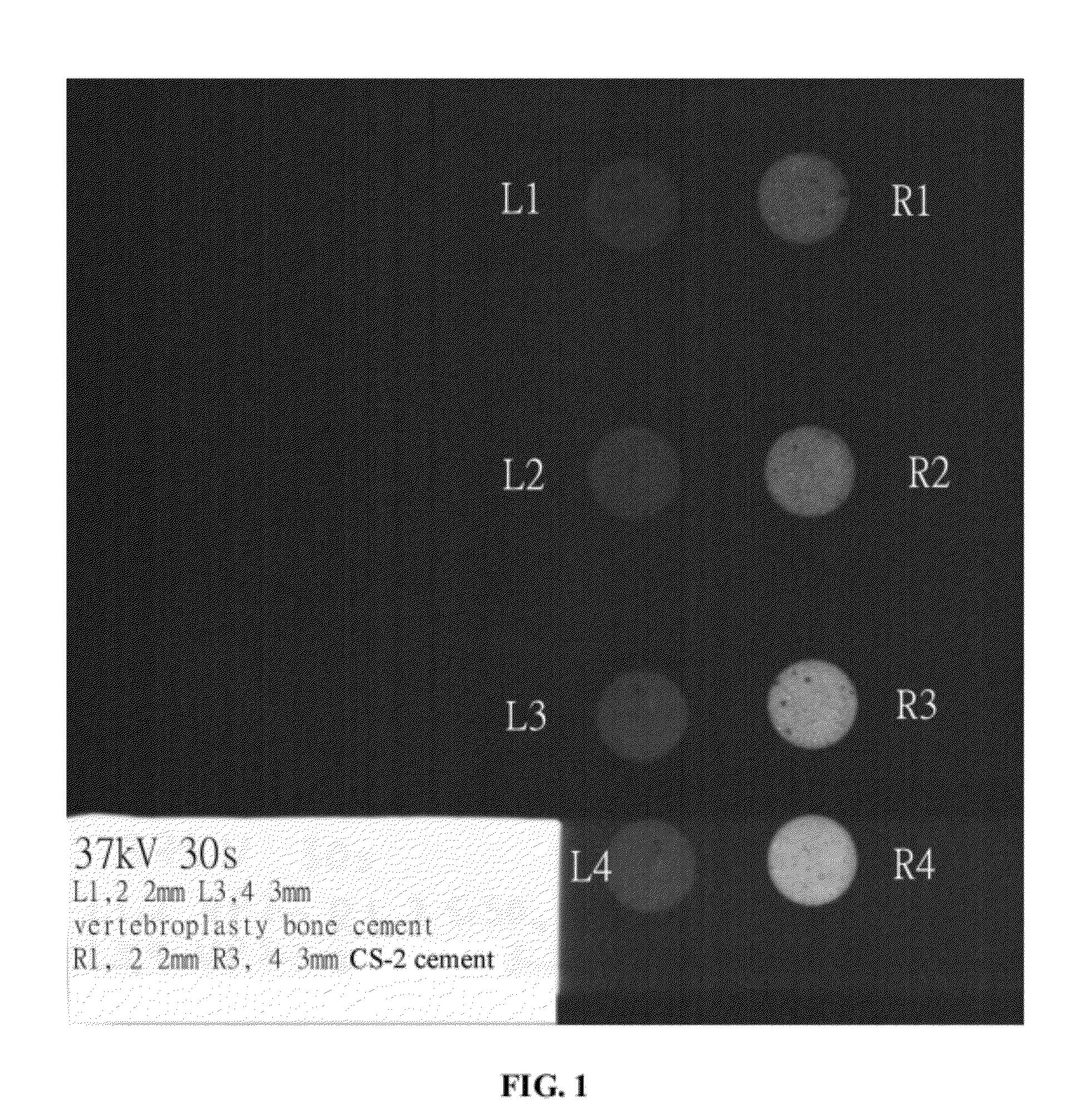 Strontium-containing bioactive bone cement