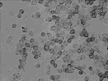 Kit and method for detecting horizontal in situ hybridization of MICRORNA-10B at the early pathological evolution stage of a variety of cancers and application thereof