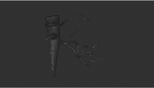 3D kidney model printing method for kidney stone surgical simulation teaching