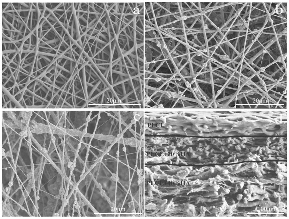 Composite electrospun membrane for promoting tendon-bone healing as well as preparation method and application of composite electrospun membrane