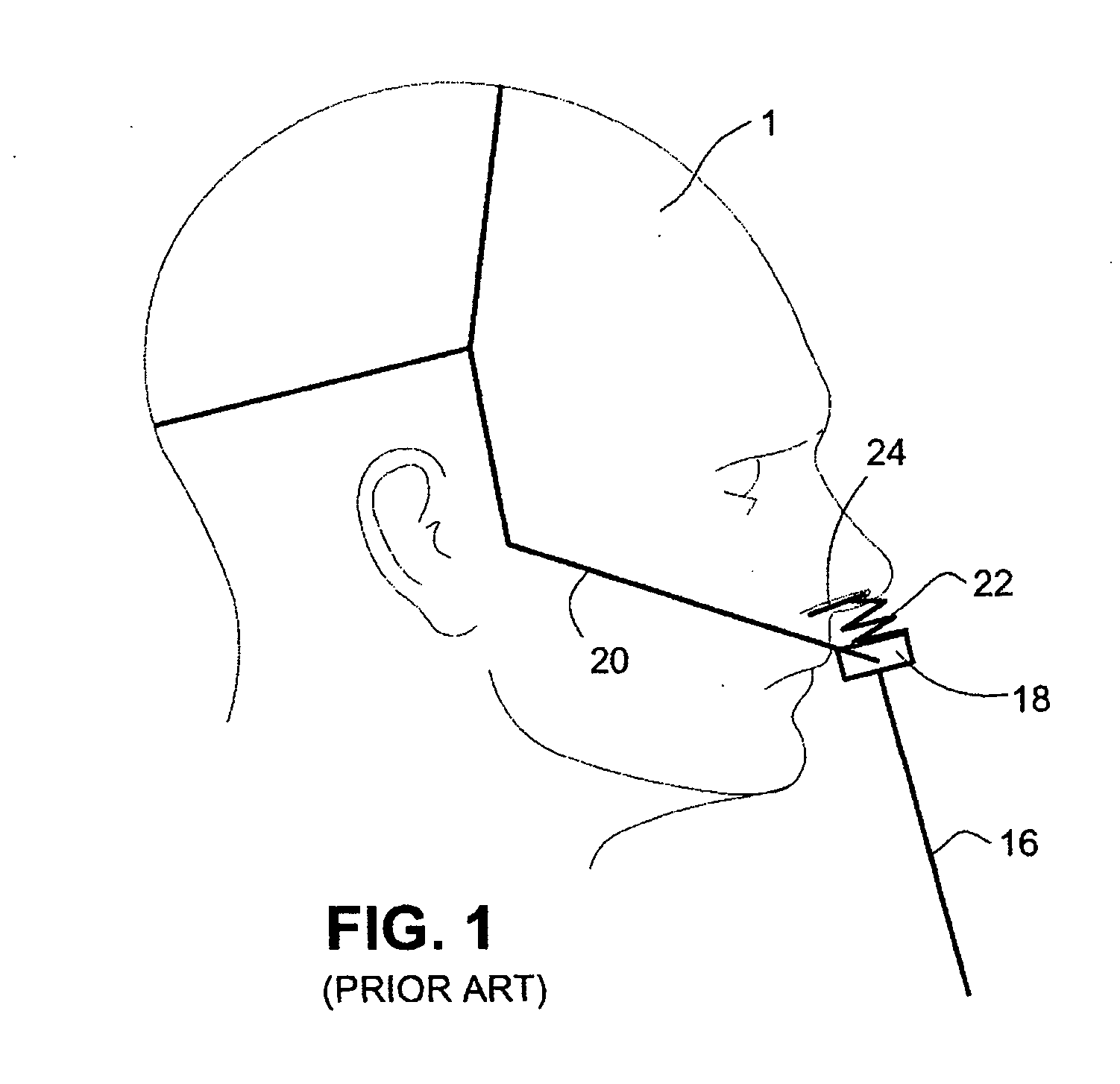 Patient interface systems