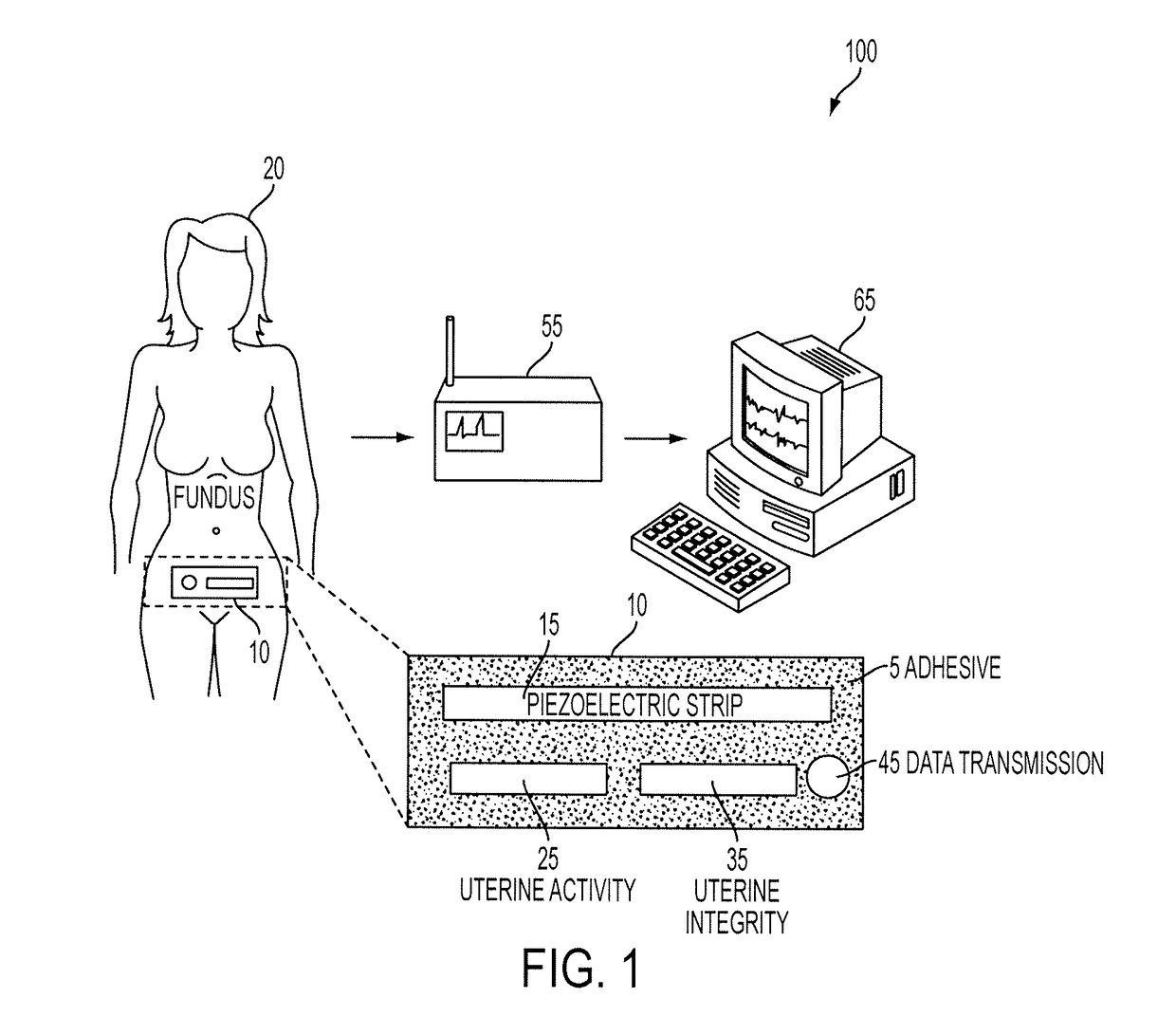 Enhanced electronic external fetal monitoring system