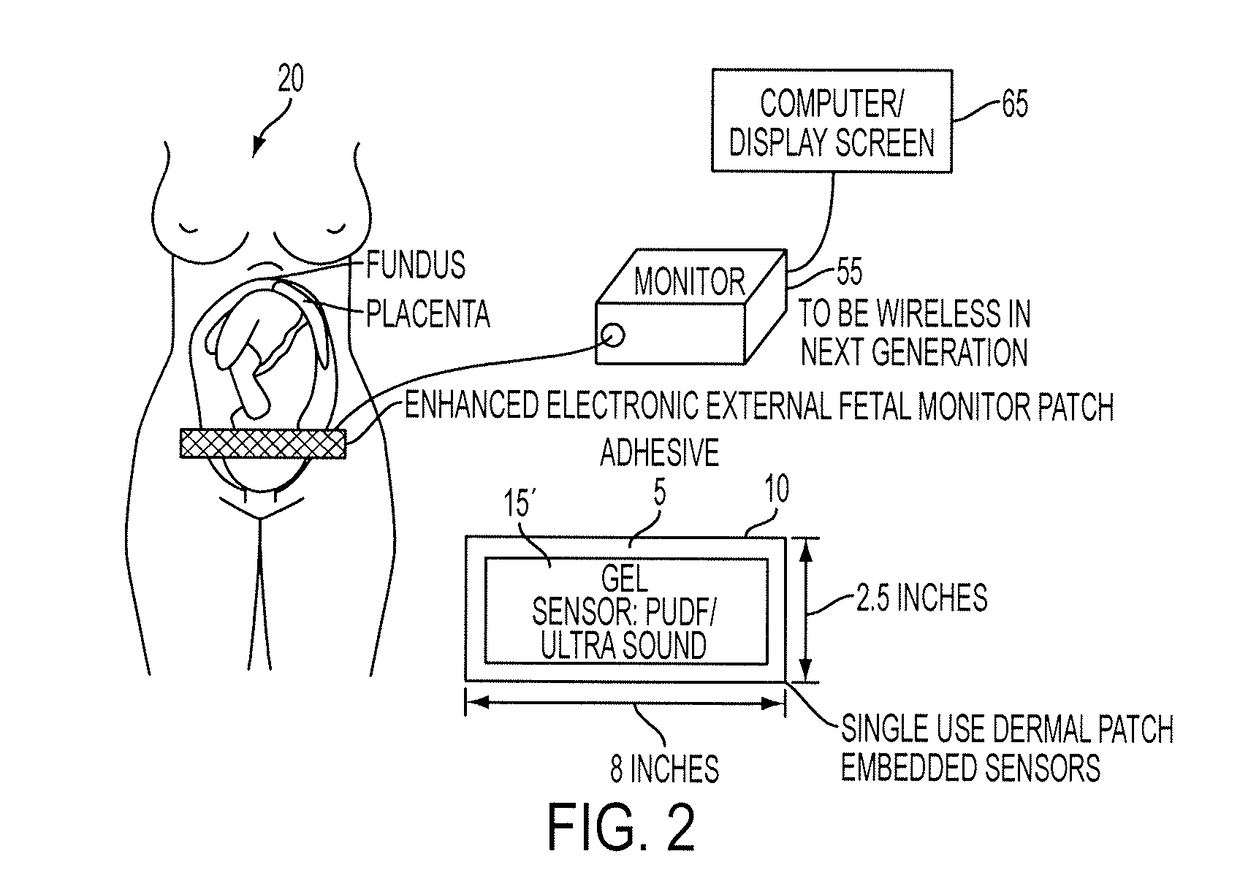 Enhanced electronic external fetal monitoring system