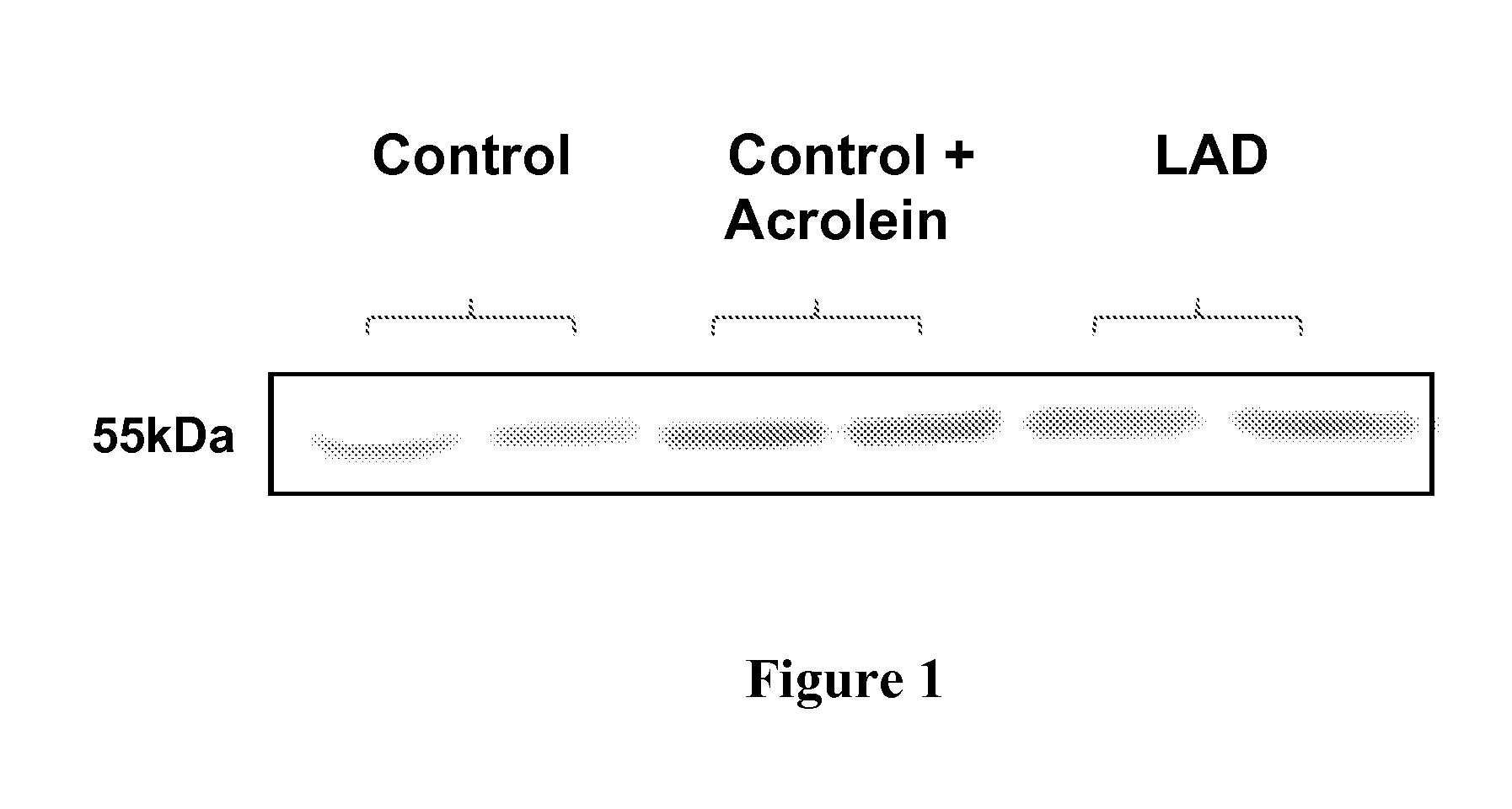 Treatment of mci and alzheimer's disease