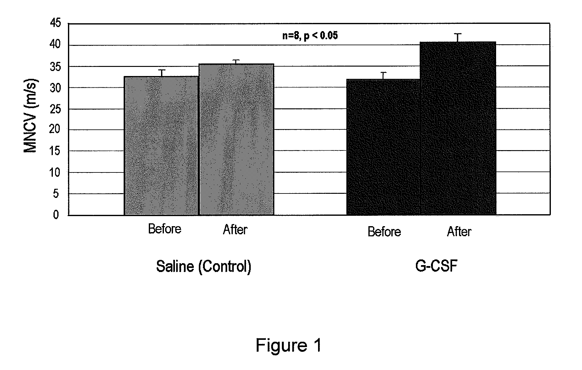 Agent comprising g-csf for prevention and treatment of diabetic peripheral neuropathy