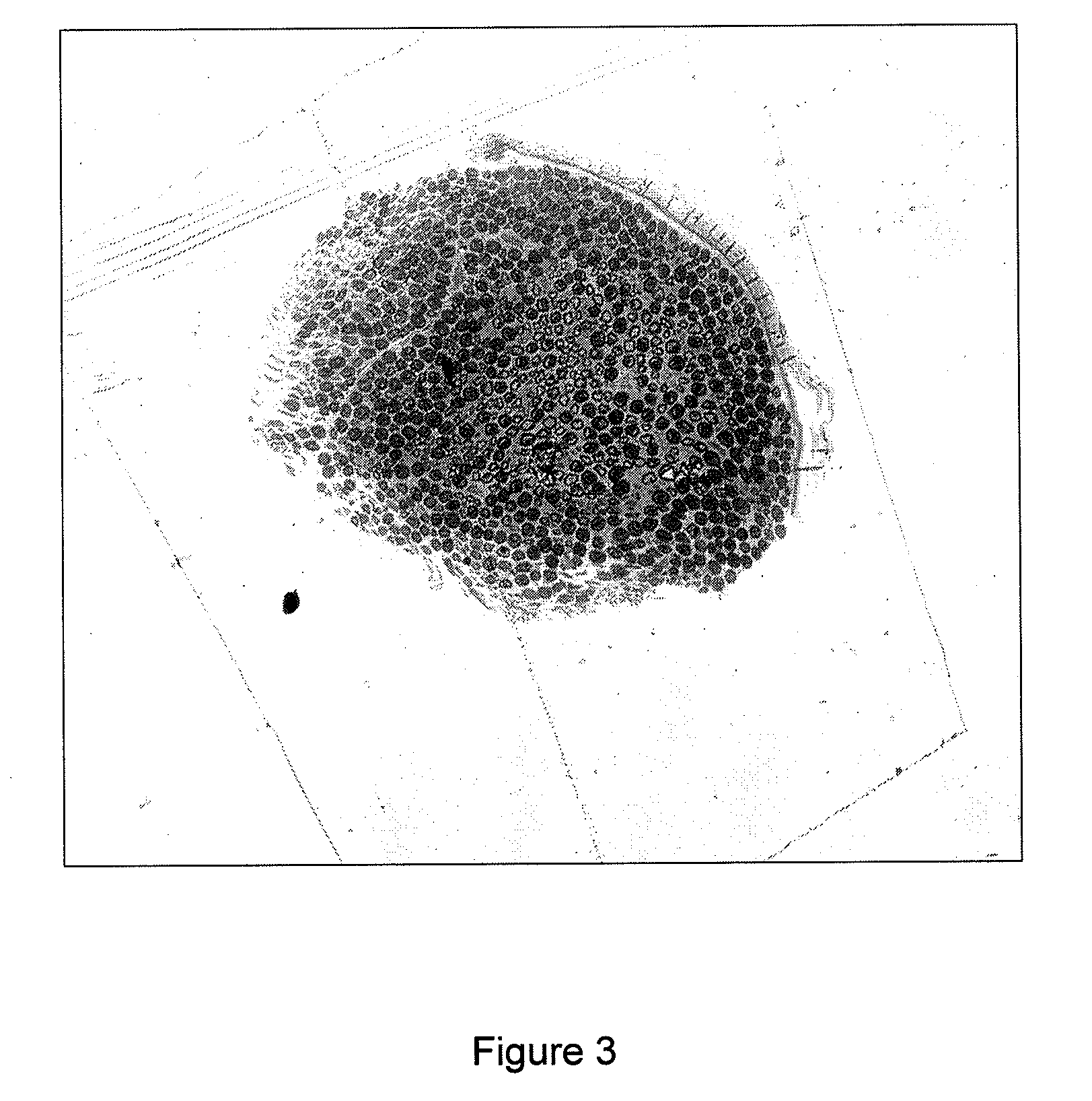 Agent comprising g-csf for prevention and treatment of diabetic peripheral neuropathy