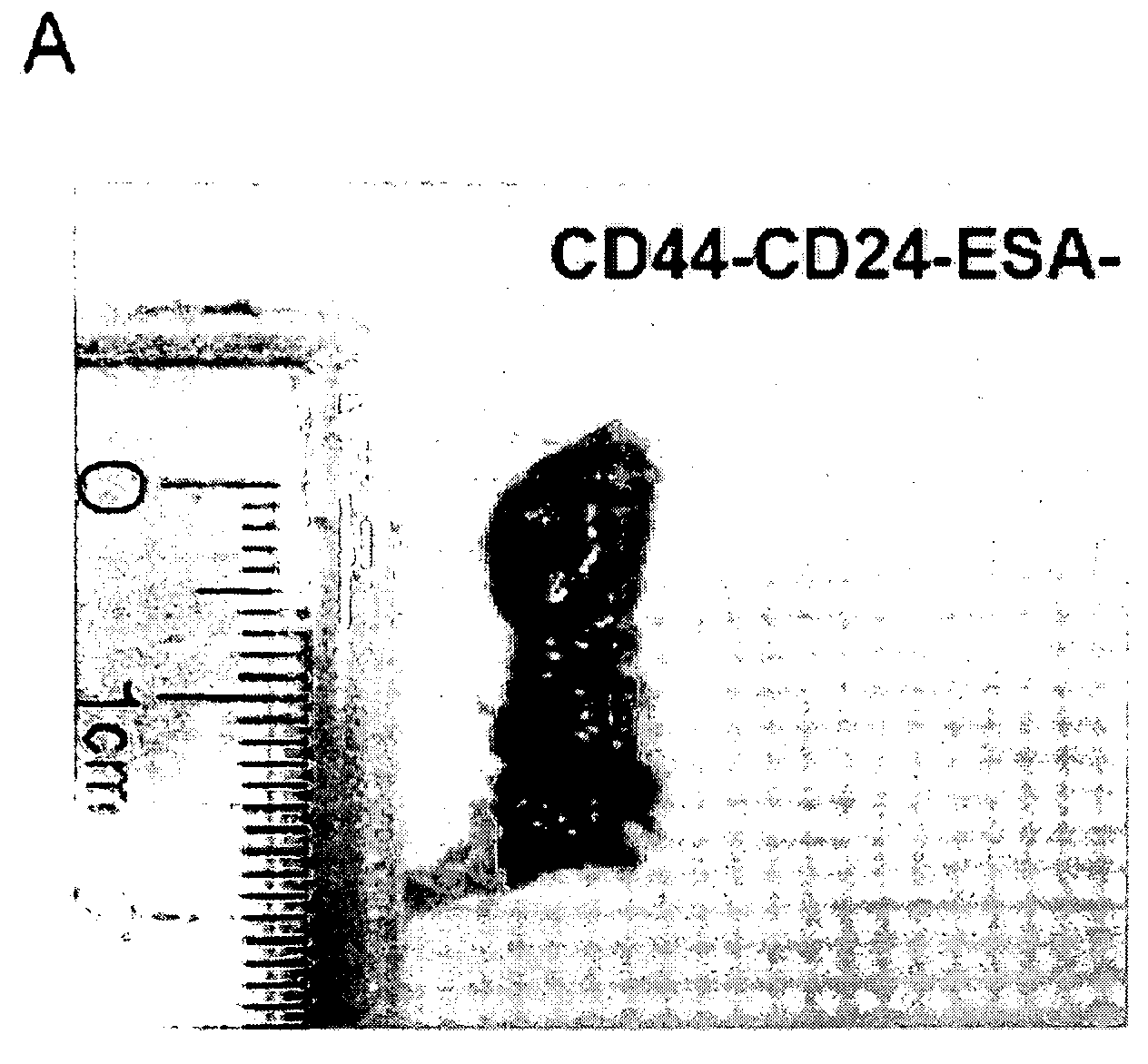 Compositions And Methods For Treating And Diagnosing Pancreatic Cancer