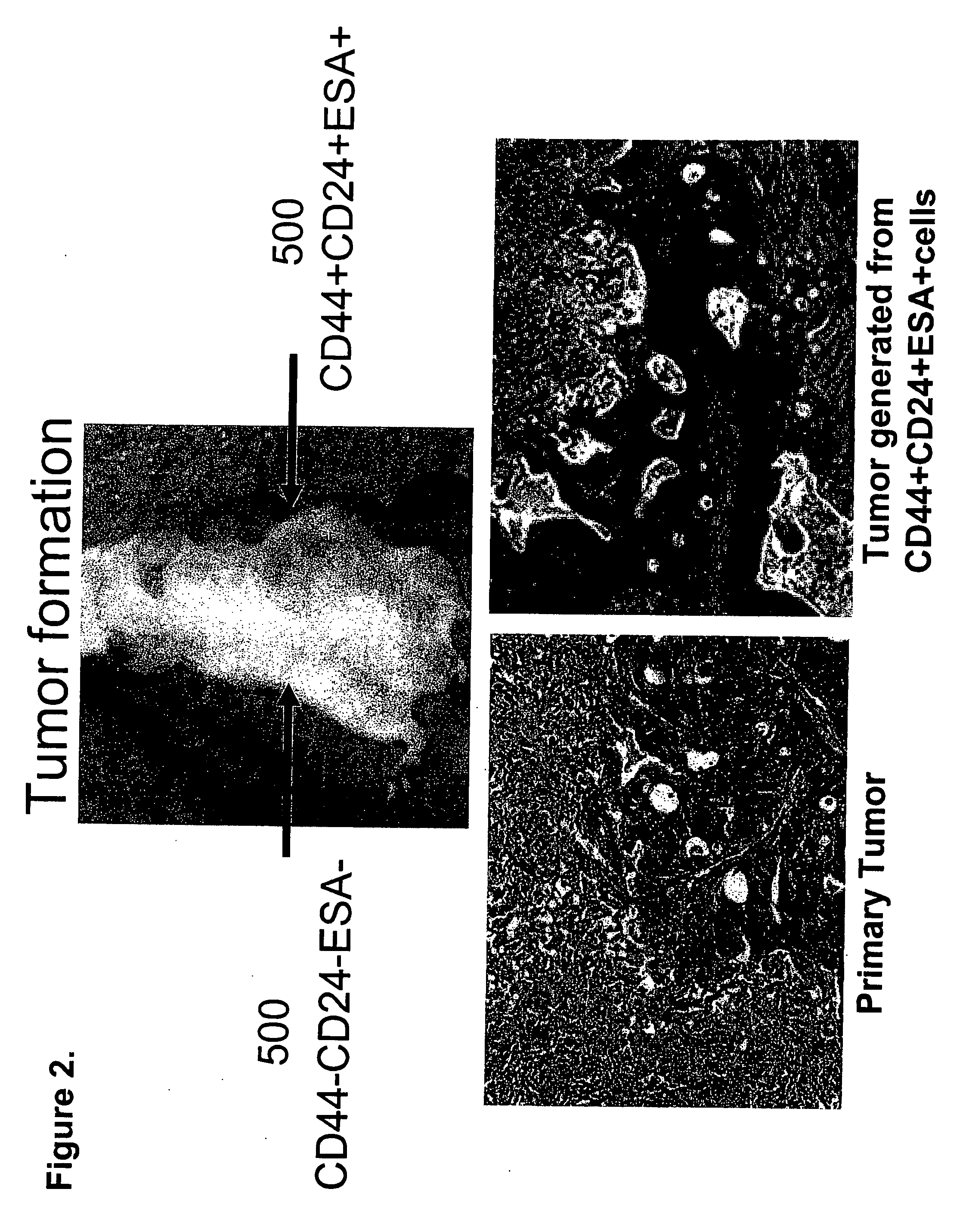 Compositions And Methods For Treating And Diagnosing Pancreatic Cancer