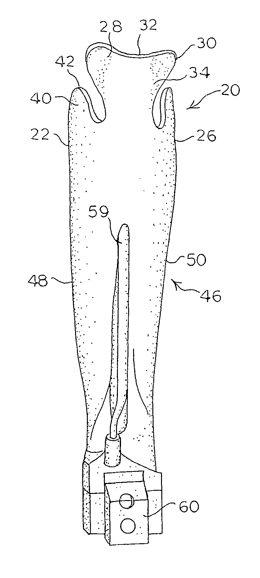 Laryngoscope blade