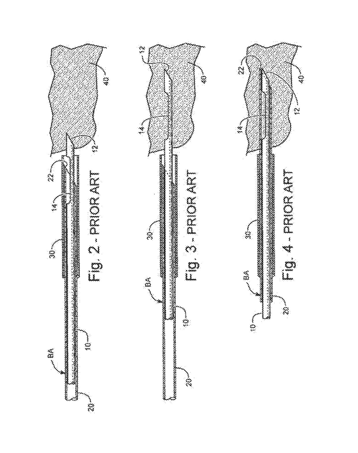 Method for excising core tissue sample