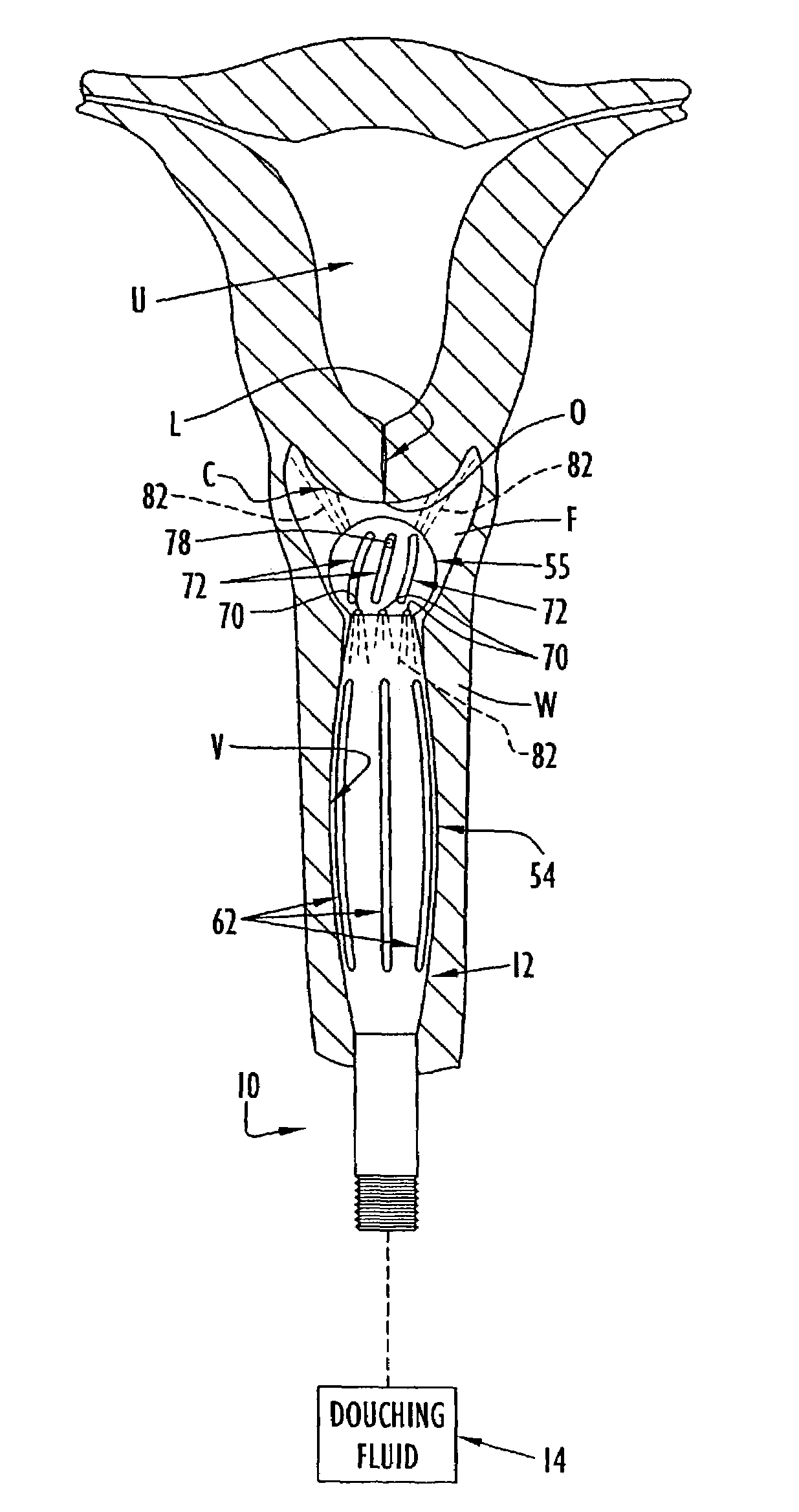 Methods of treating abnormal biological conditions by vaginal douching