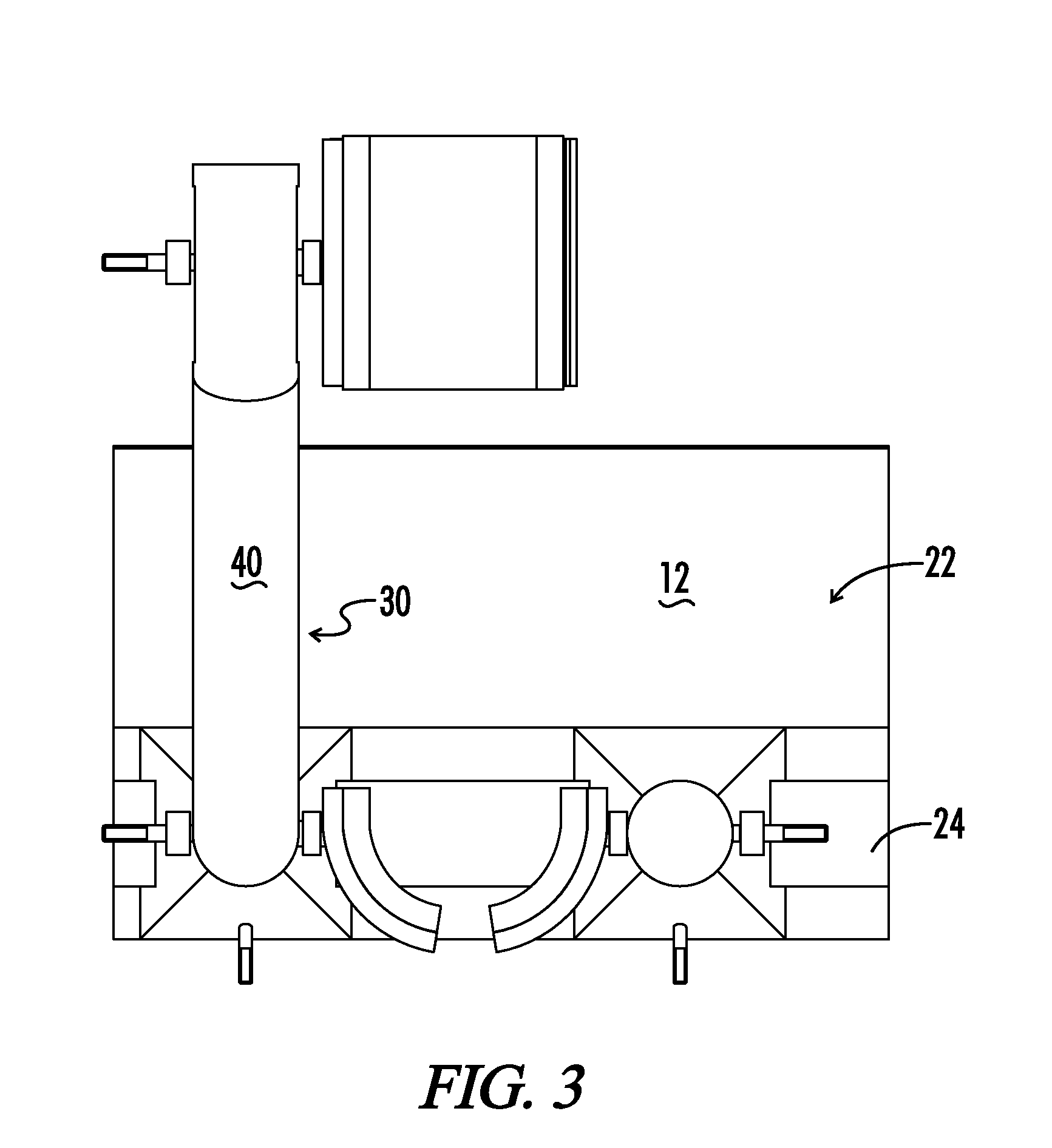 Arm Stabilizer for Elbow Surgical Procedure