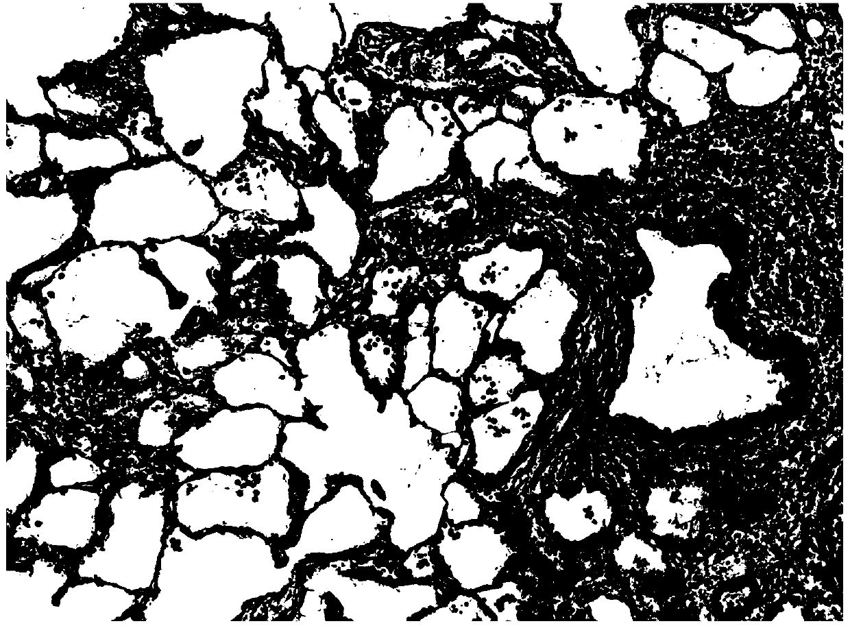 A traditional Chinese medicine composition for treating diffuse pulmonary fibrosis and its application