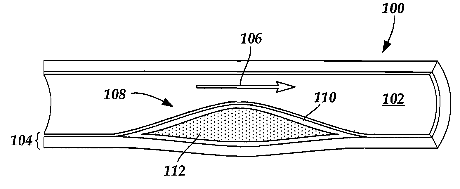 System and method for in vivo imaging of blood vessel walls to detect microcalcifications