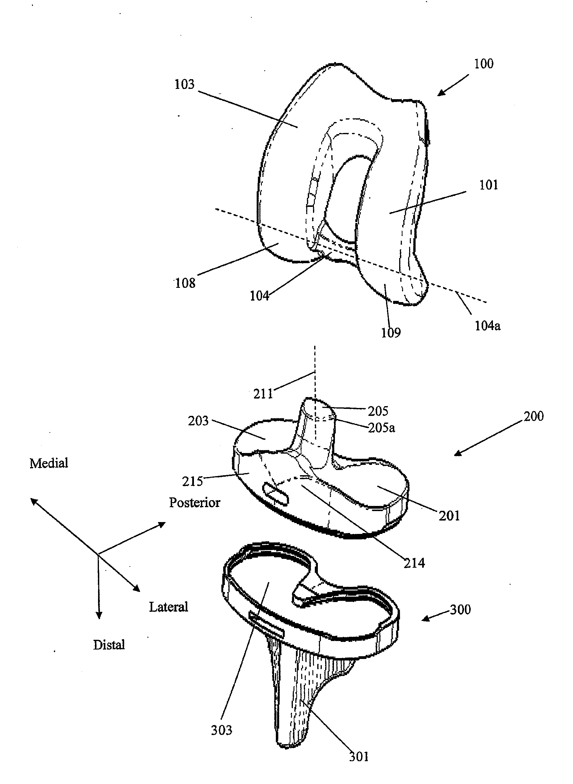 Prosthetic joint