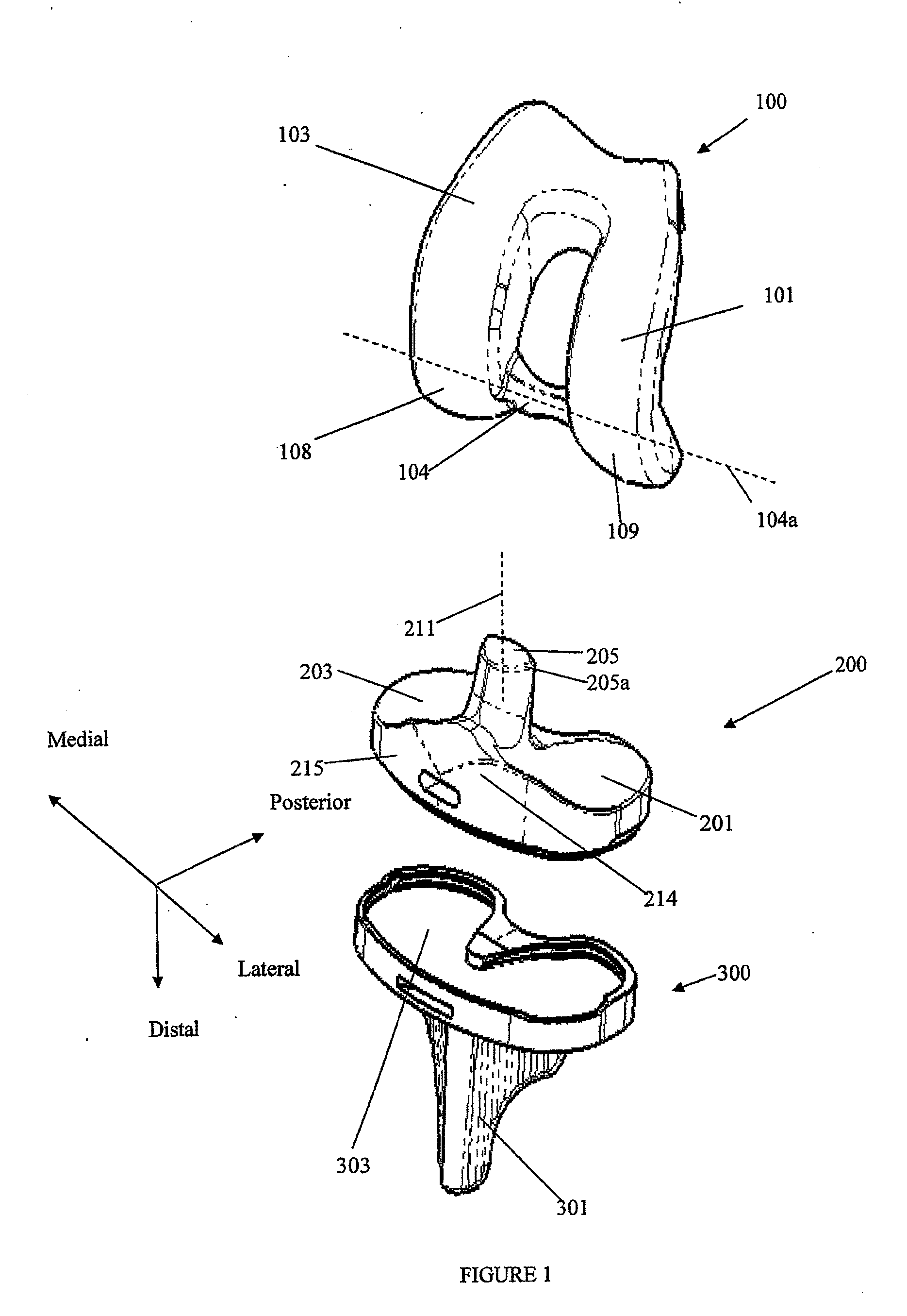 Prosthetic joint