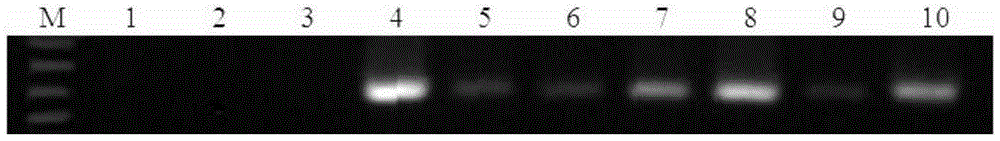 A Real-time Fluorescent Quantitative PCR Method for Detecting the Pathogenic Bacteria of Verticillium Wilt in Chinese Cabbage