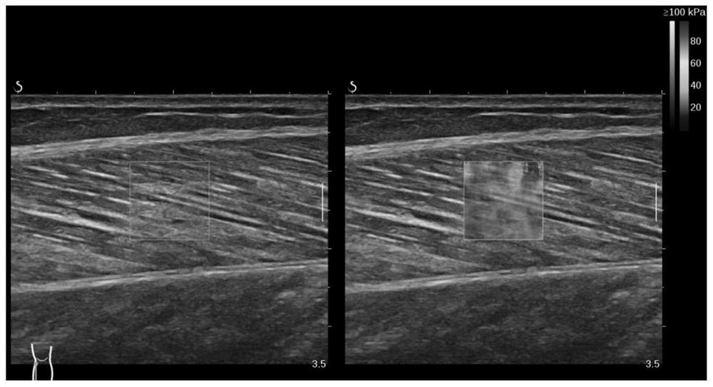 Muscle ultrasonic elastography optimization method and system