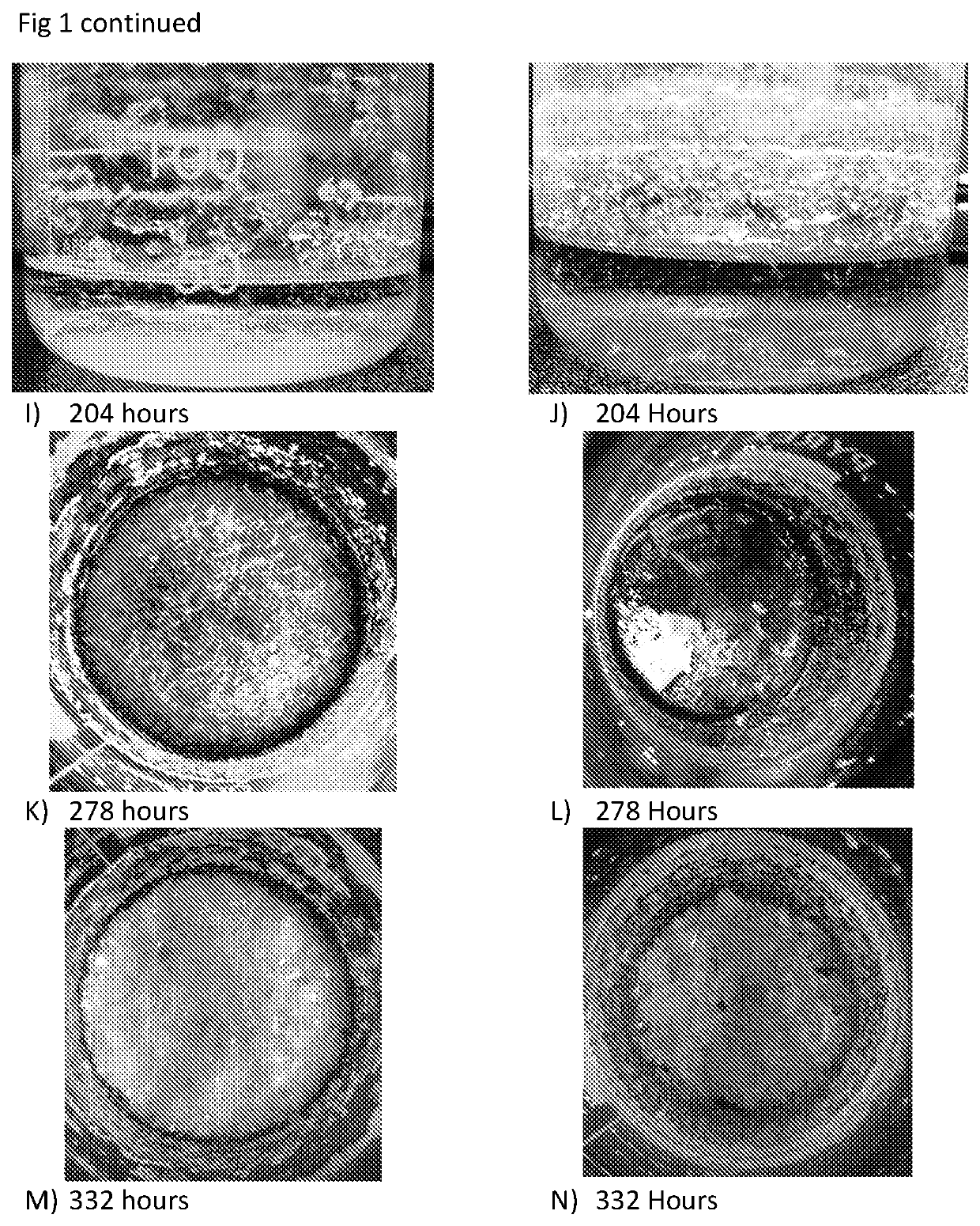 Treatment of cholesterol crystal formation