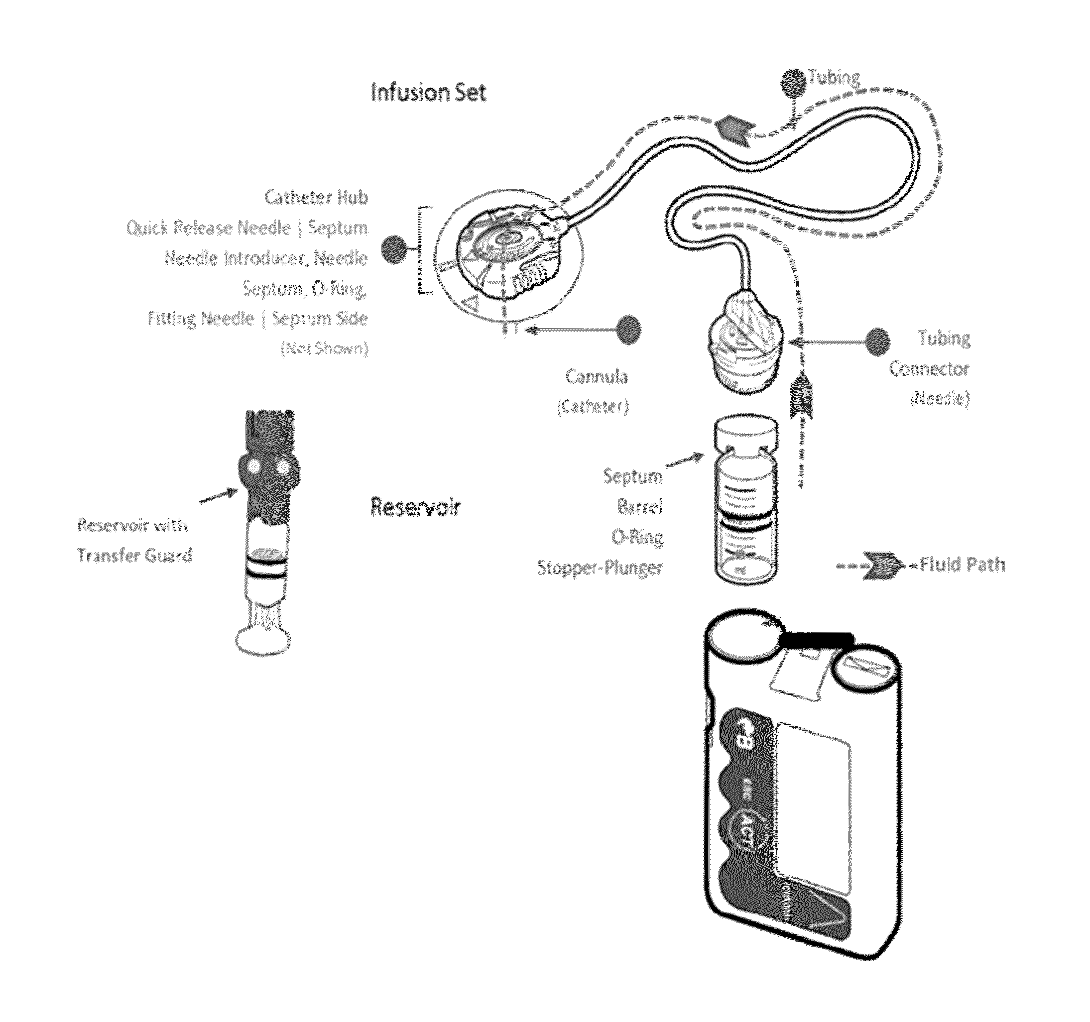 Methods and systems for inhibiting foreign-body responses in diabetic patients