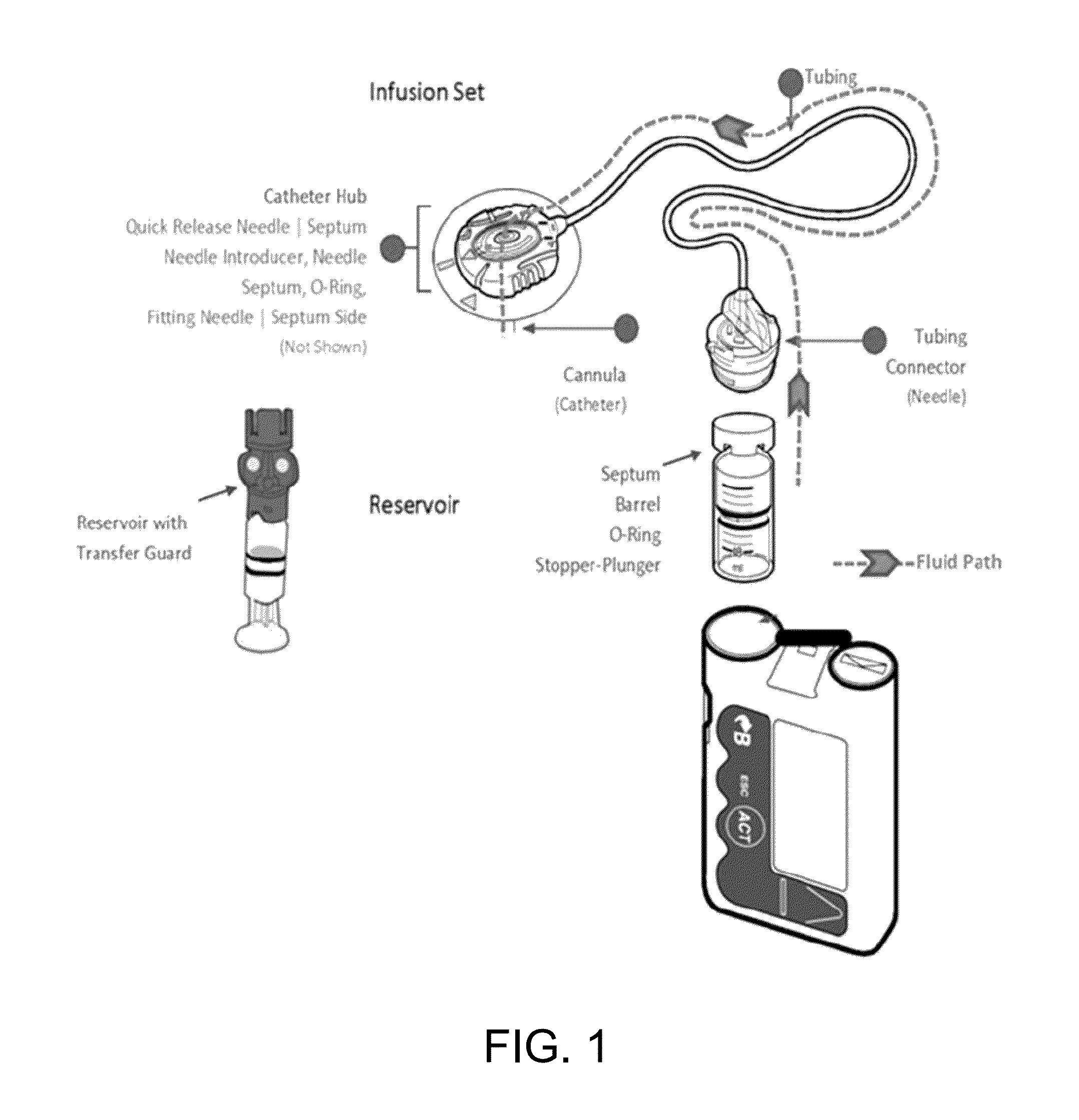 Methods and systems for inhibiting foreign-body responses in diabetic patients