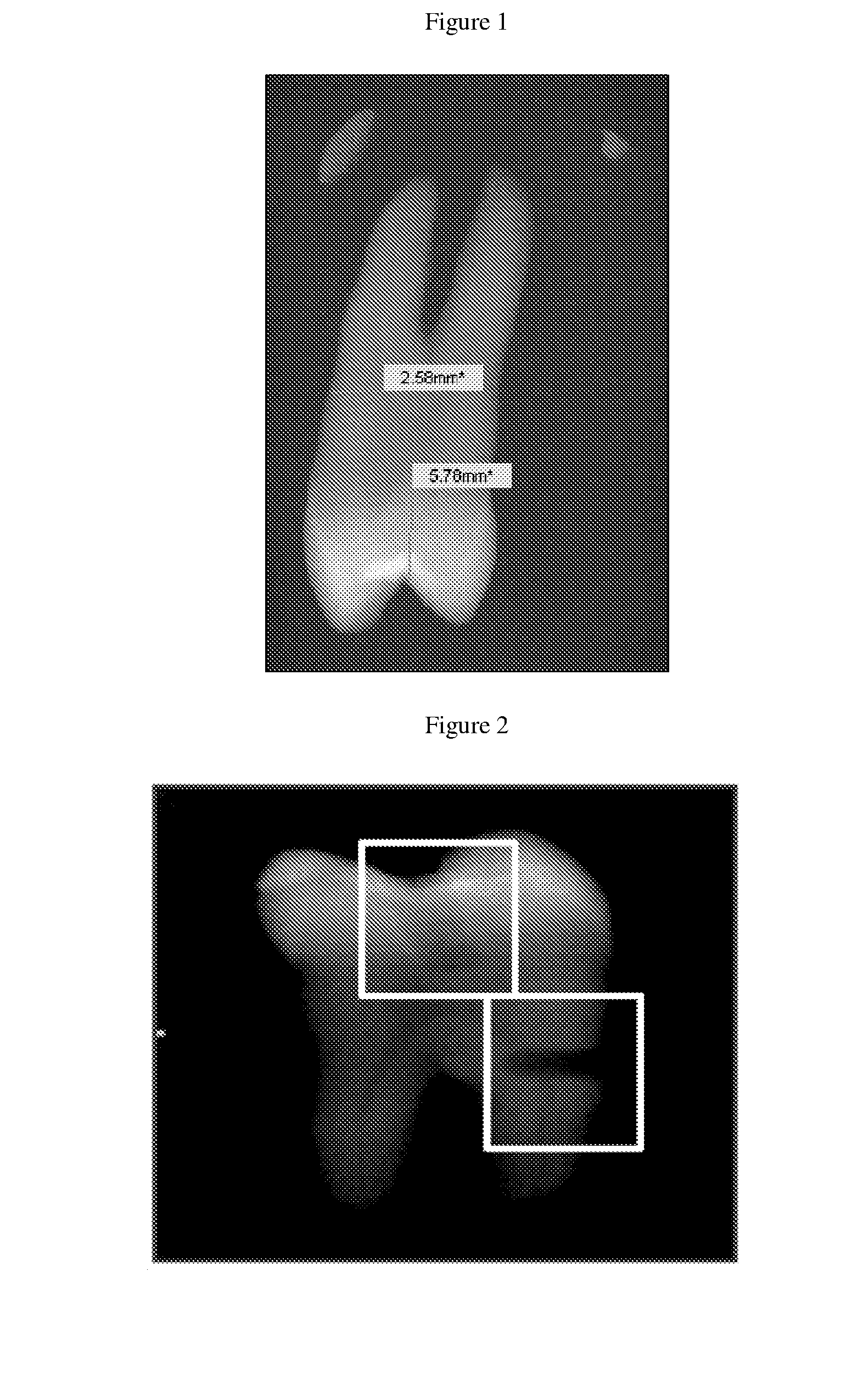 Method, systems and kit for forensic identification, post mortem interval estimation and cause of death determination by recovery of dental tissue in physiological conditions