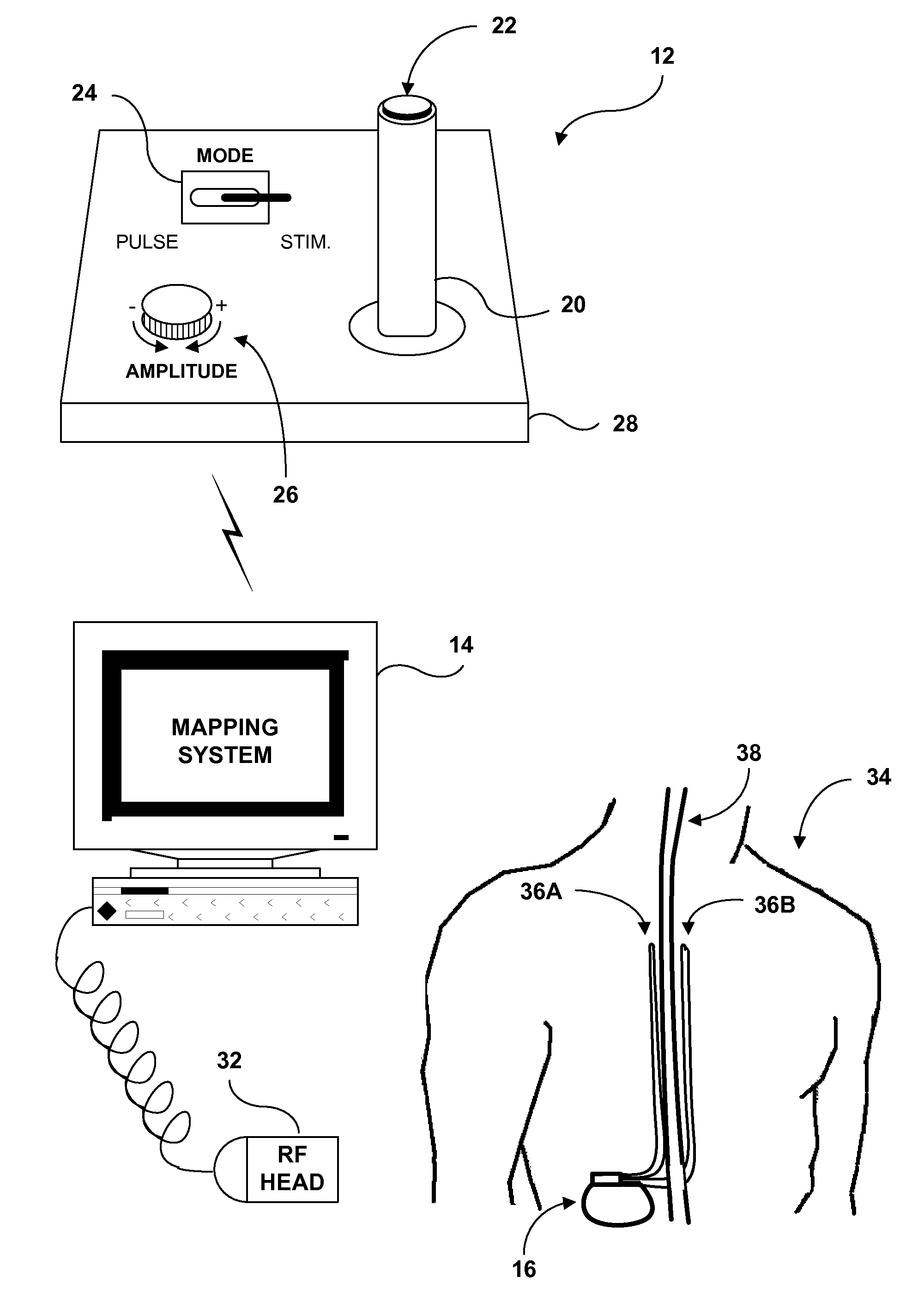 Neurostimulation therapy manipulation