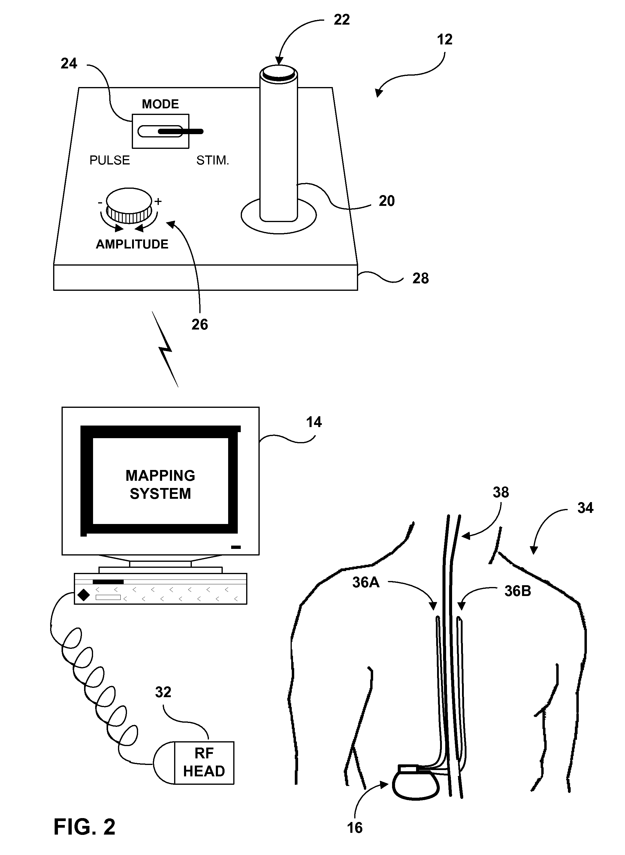 Neurostimulation therapy manipulation