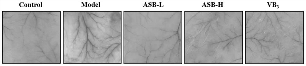 Application of sodium bisulfite andrographolide in preparation of drug or sunscreen for preventing and treating light-induced skin injury disease