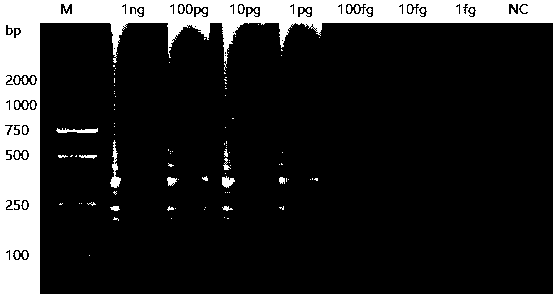 LAMP primer group for detecting helicobacter pylori cytotoxin related protein cagA and application thereof