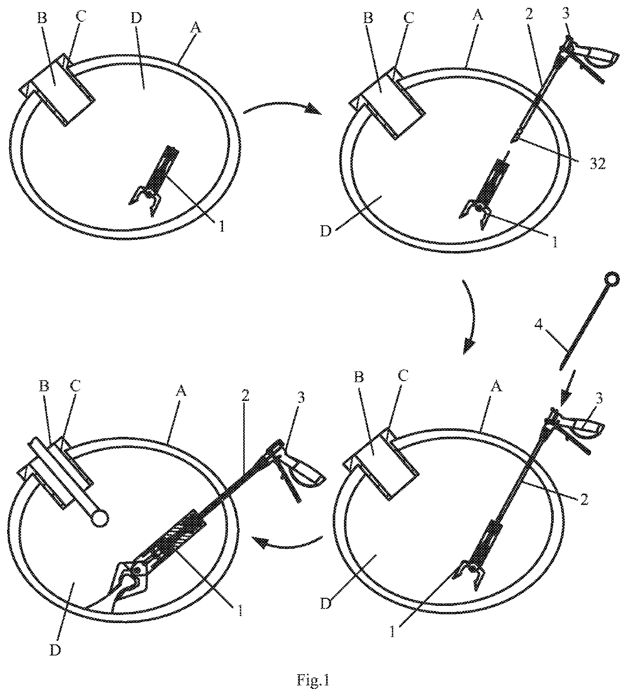 Endoluminal surgery device