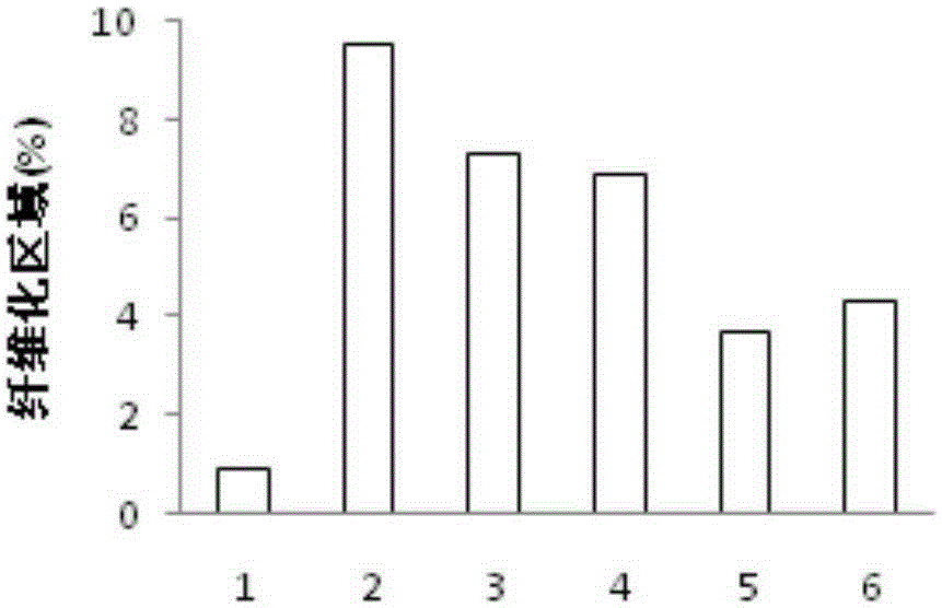 Compound composition of obeticholic acid and berberine and applications thereof