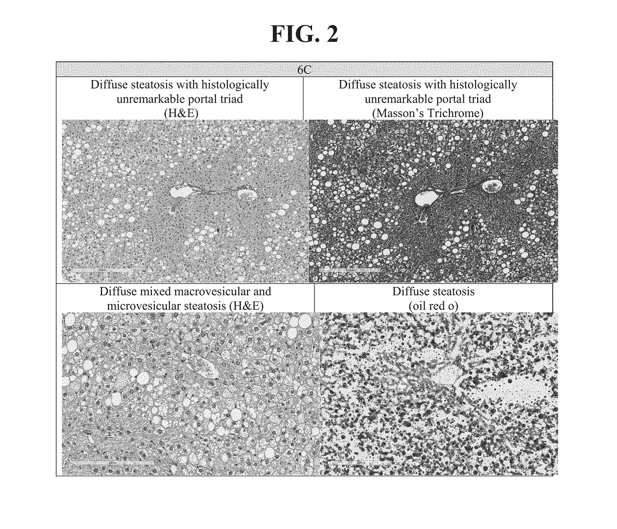 Herbal drug composition containing probiotic and optionally prebiotic and/or active pharmaceutical ingredient