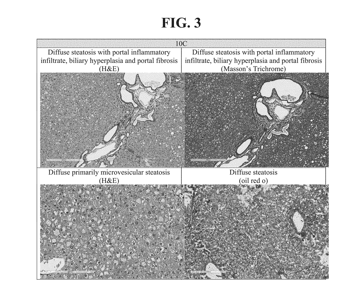 Herbal drug composition containing probiotic and optionally prebiotic and/or active pharmaceutical ingredient