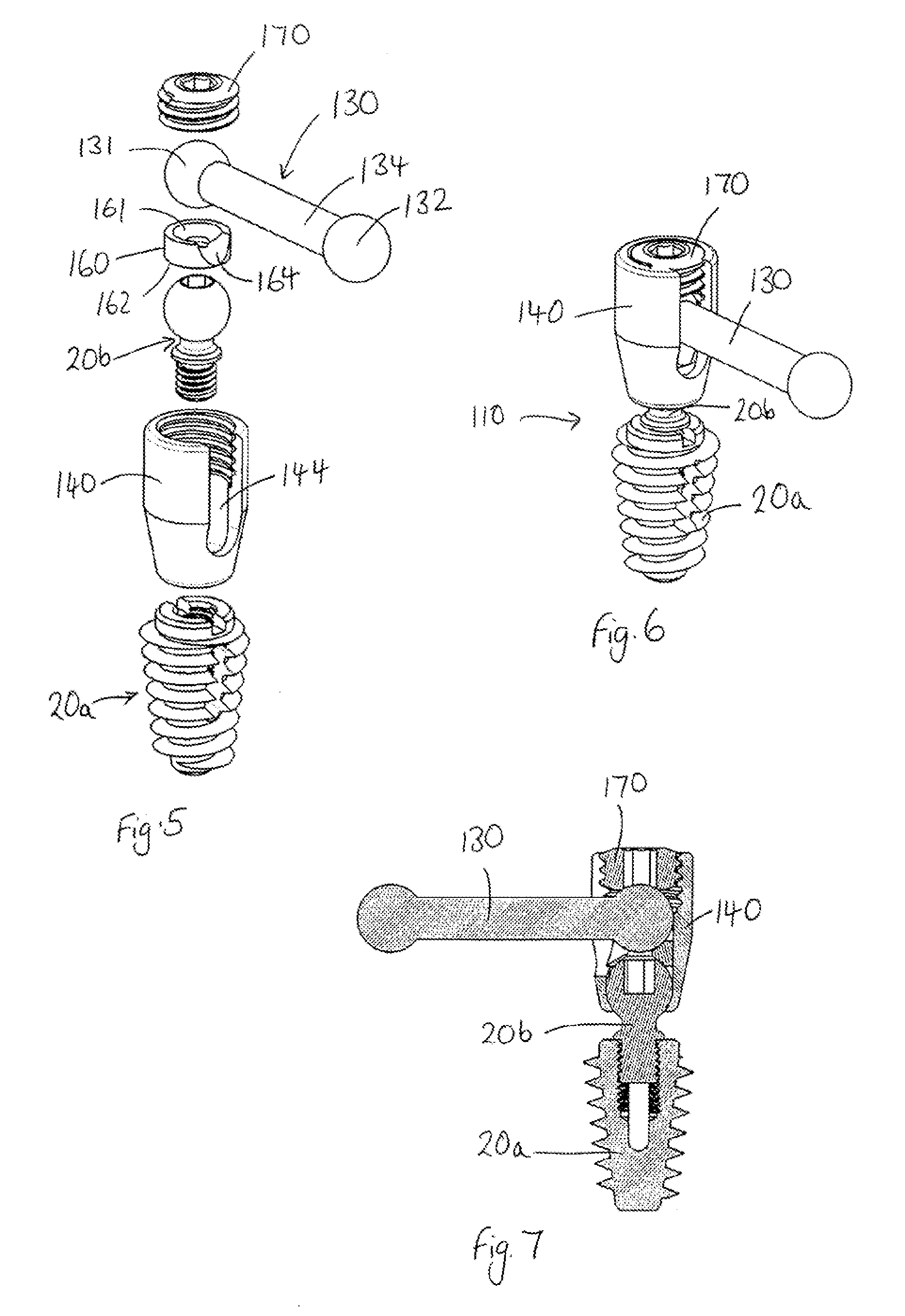 Spinal Implant Assembly