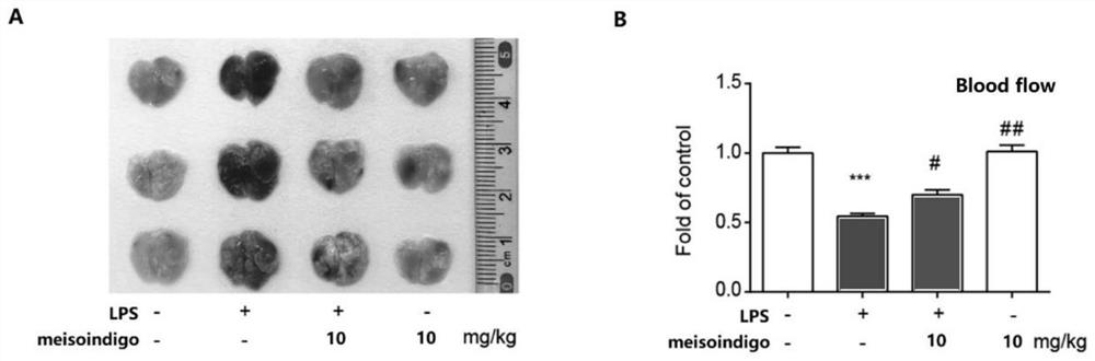 Application of meisoindigo in preparation of medicine for treating acute lung injury