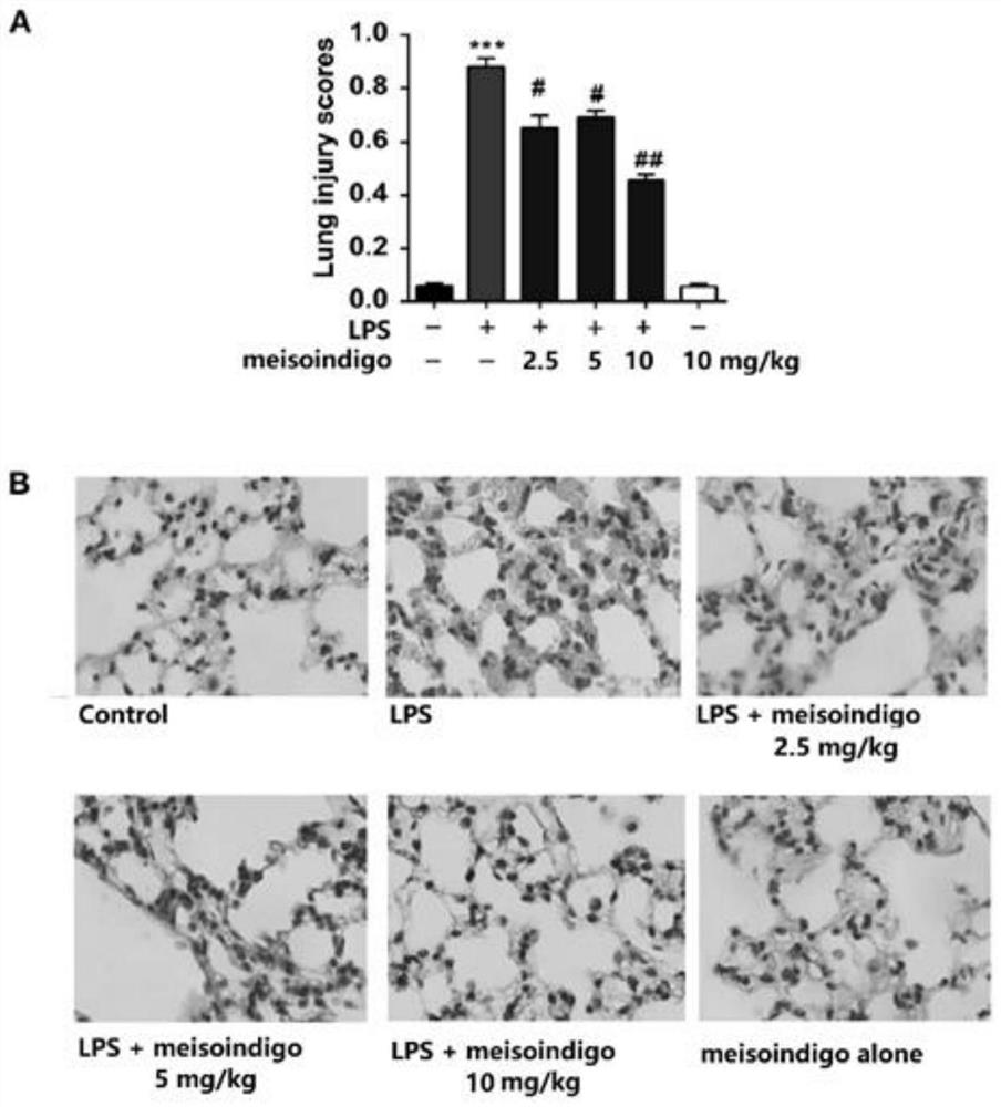 Application of meisoindigo in preparation of medicine for treating acute lung injury