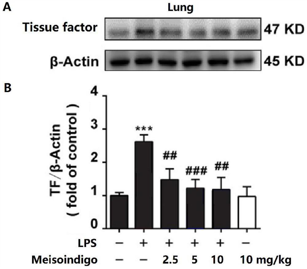 Application of meisoindigo in preparation of medicine for treating acute lung injury