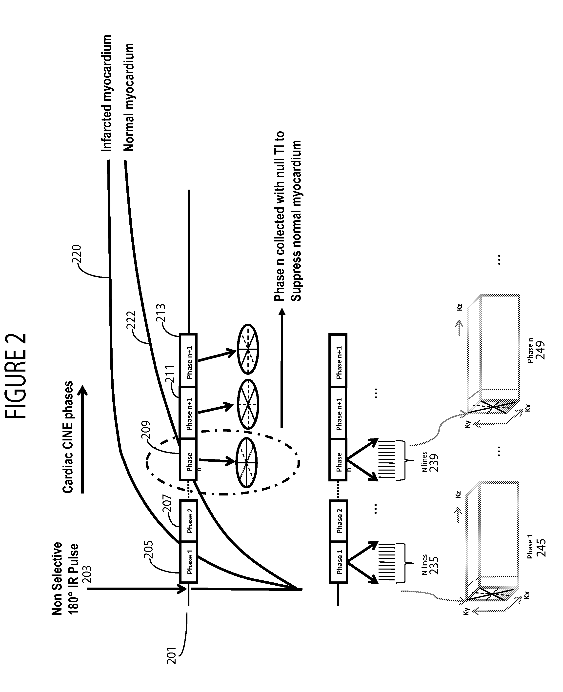 System for Cardiac MR & MR Cine Imaging Using Parallel Image Processing