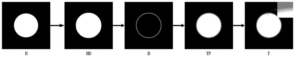 Endoscopic image highlight removal method based on non-convex low-rank matrix decomposition