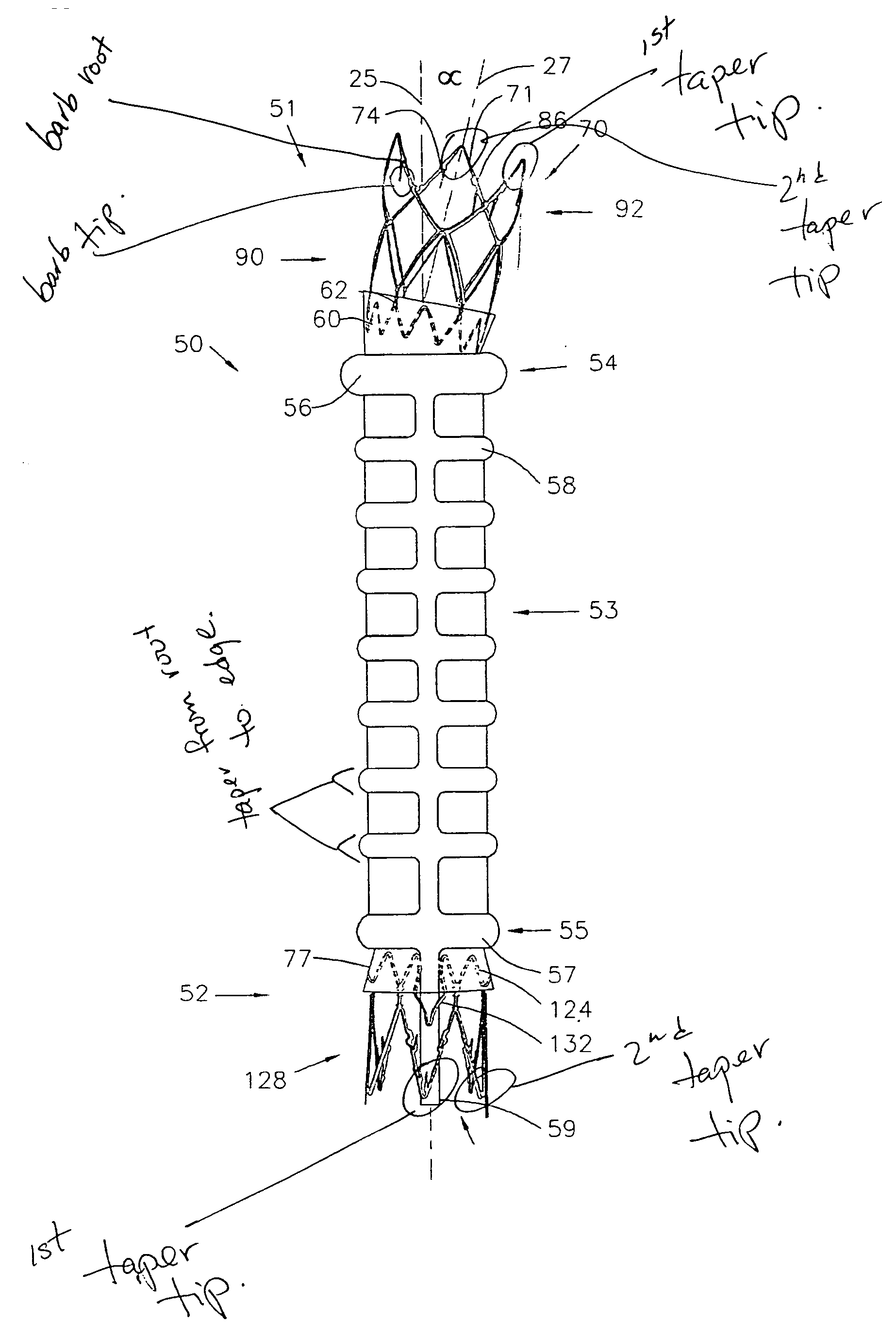 Stent