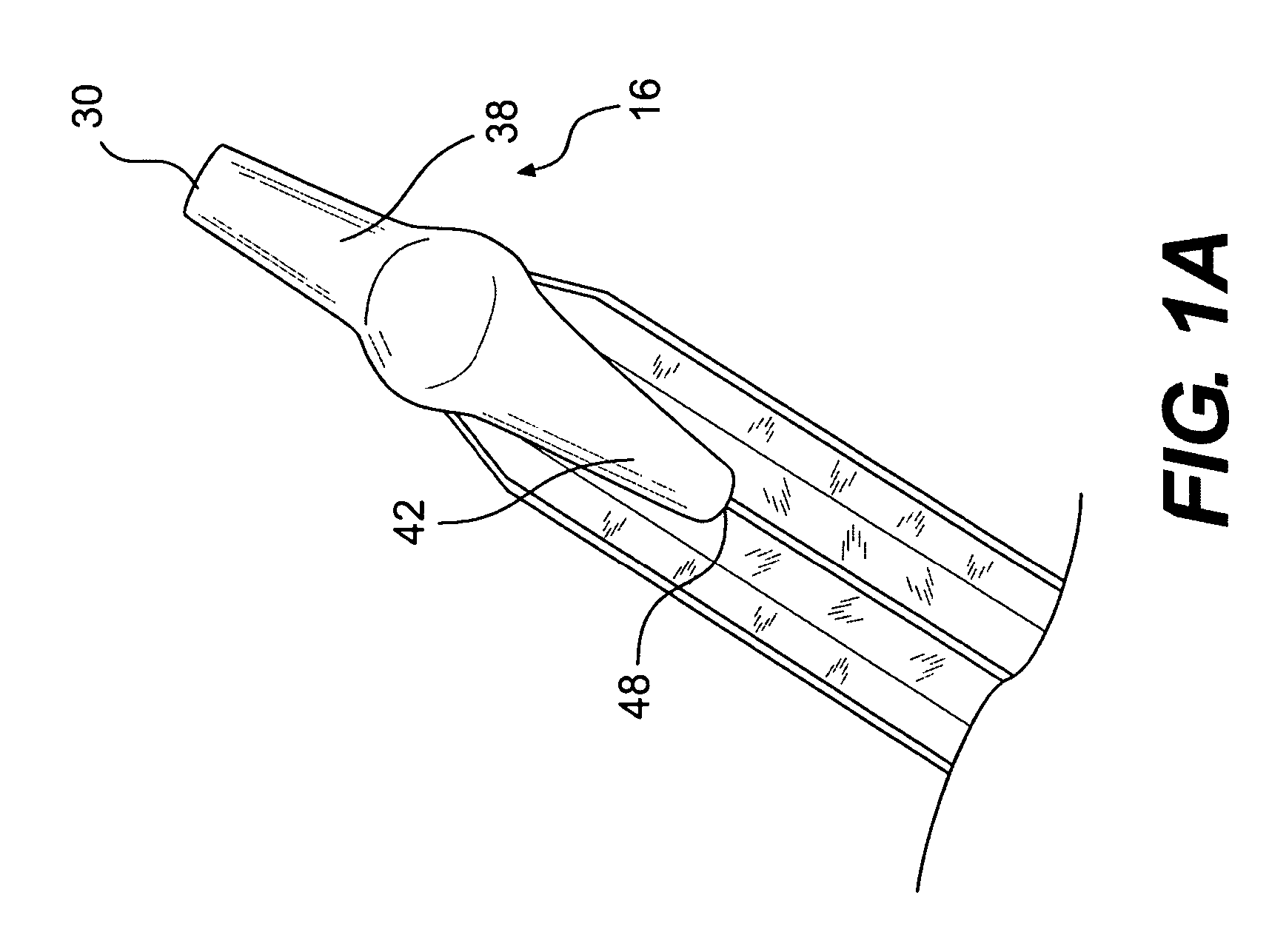 Stent