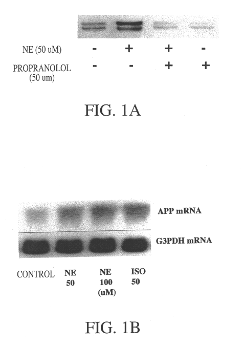 Compositions and methods for treatment of neurological disorders and neurodegenerative diseases