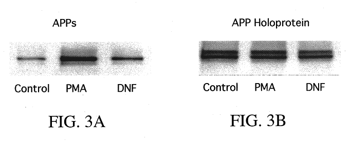 Compositions and methods for treatment of neurological disorders and neurodegenerative diseases