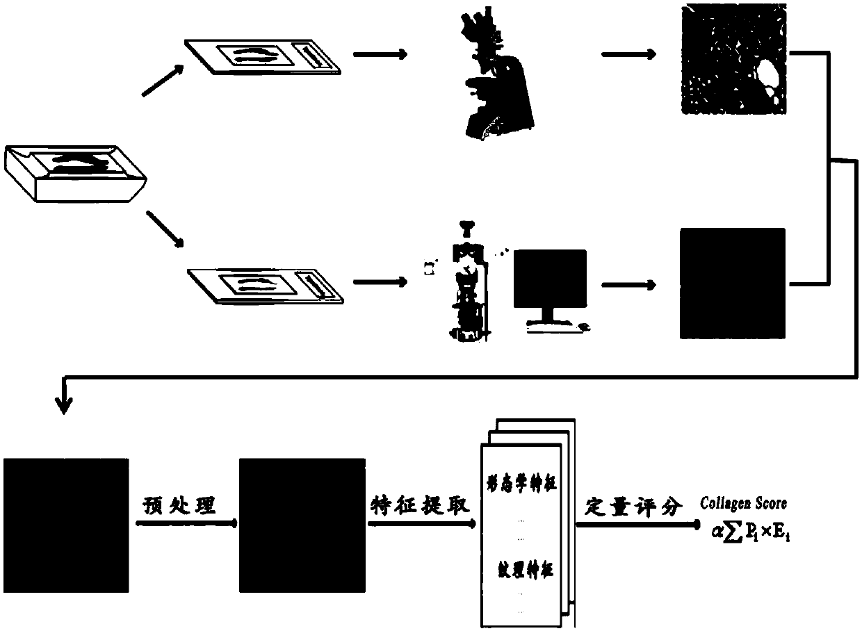 Evaluation method of paracancerous collagenous tissue of early gastric cancer excision specimen