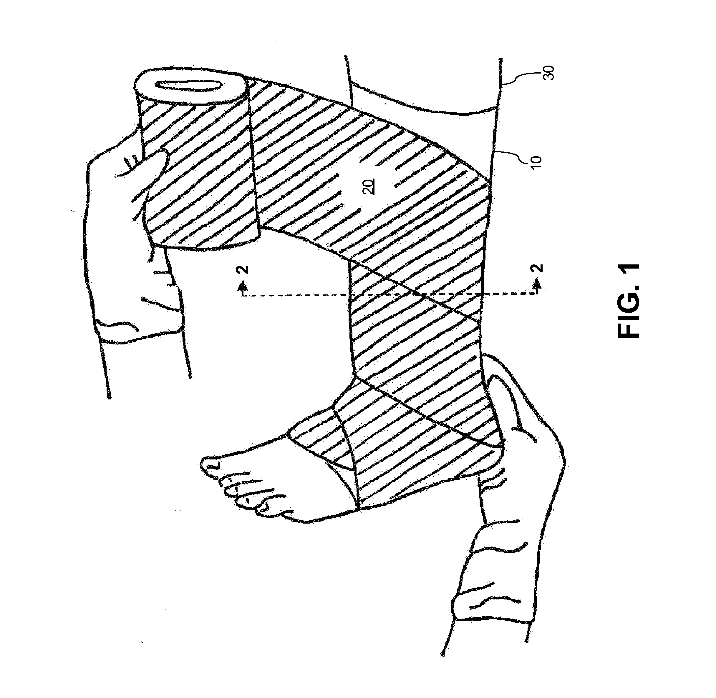 System and method for treating leg ulcers