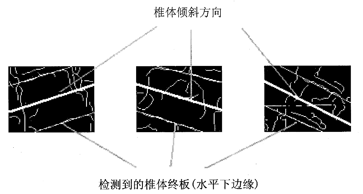 Scoliosis X-ray image-assisted diagnostic system and method thereof