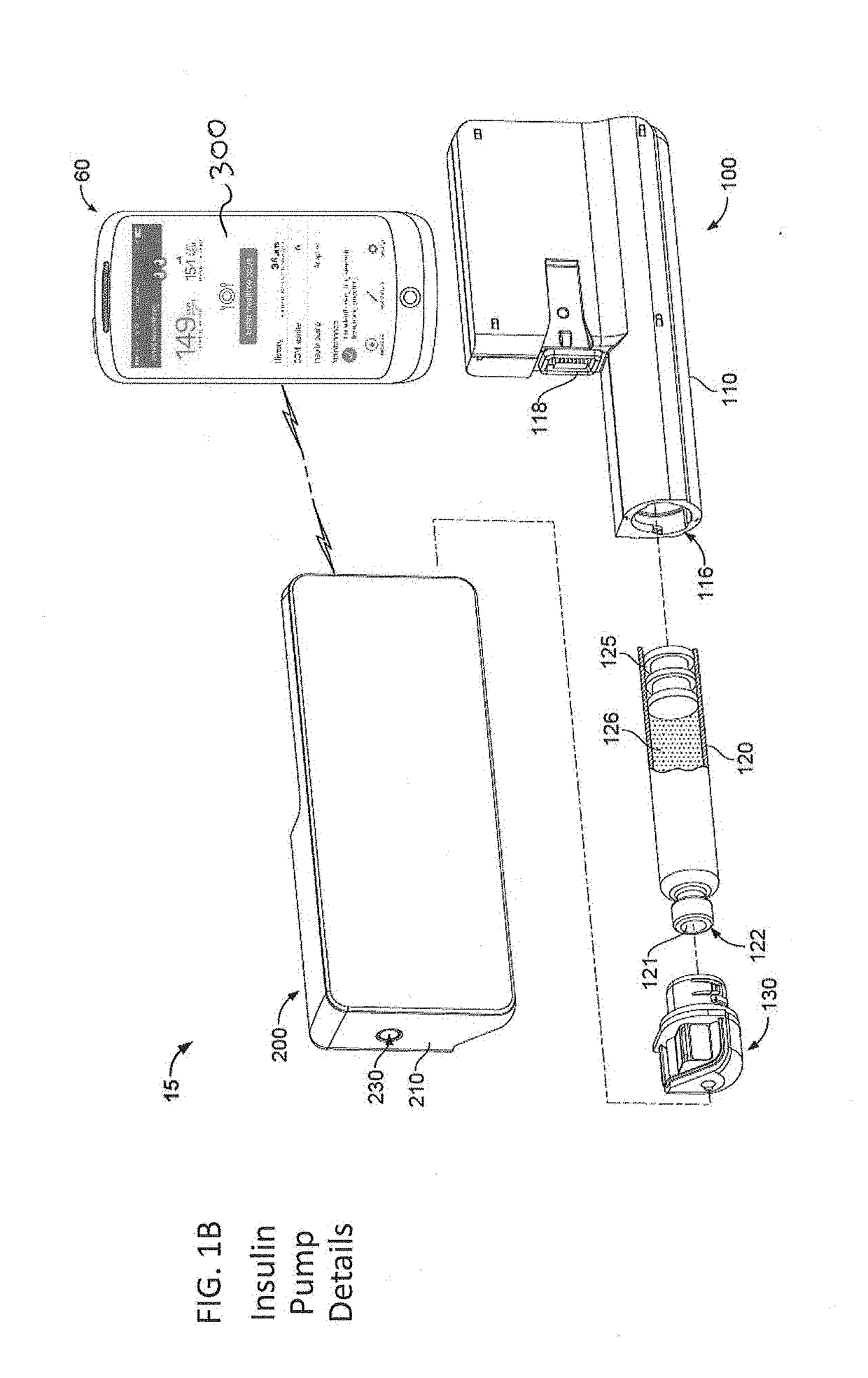 User interface for diabetes management system