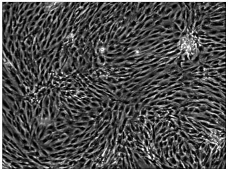 Extraction reagent and extraction method of human autologous stromal vascular fractions SVF